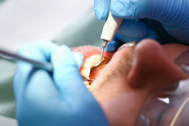 Best Walk-In Emergency Dentist in North Lima, OH