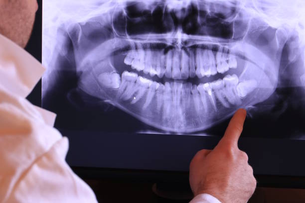 Best Emergency Treatment for Toothache in North Lima, OH